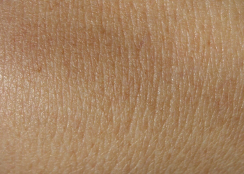 29 juin à Saumur. Cancer de la peau : Cette mutuelle propose un dépistage gratuit du mélanome